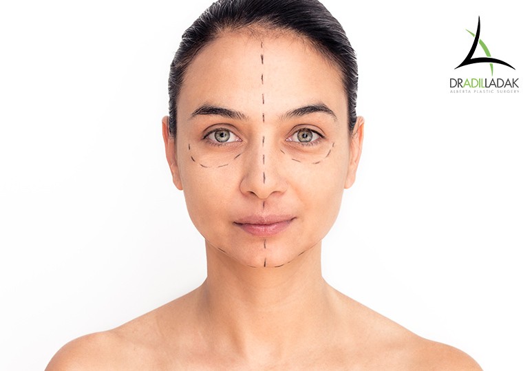 Is a Facelift the Right Option For You?