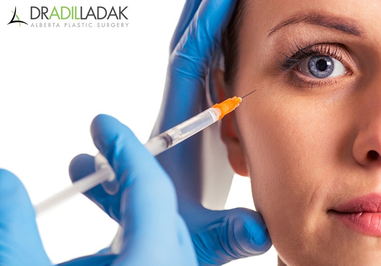 Botox for Facial Asymmetry