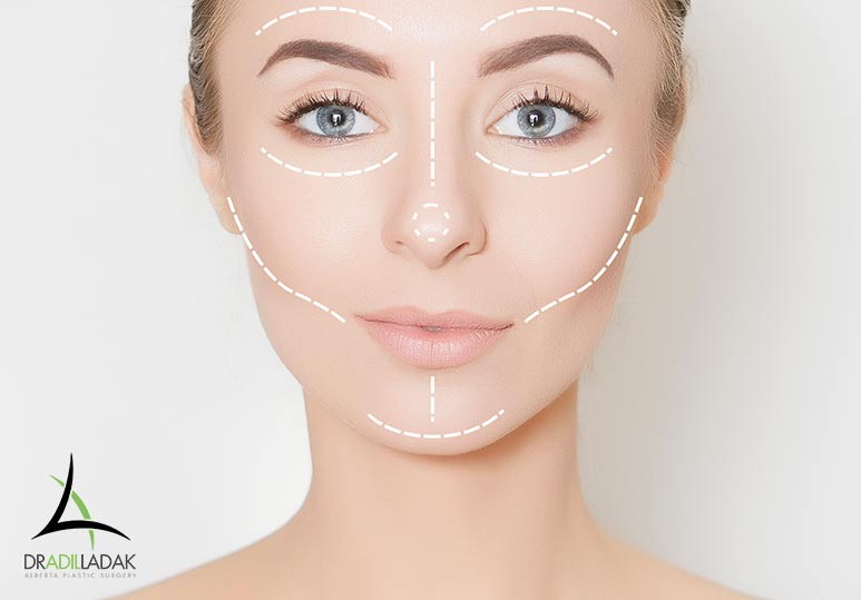 facial asymmetry surgery, facial asymmetry Edmonton, Edmonton plastic surgery, Edmonton plastic surgeon, Alberta Plastic Surgery