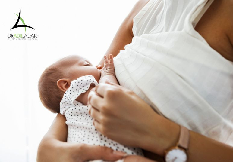 Successful Breastfeeding After Breast Implants! - Breastfeeding