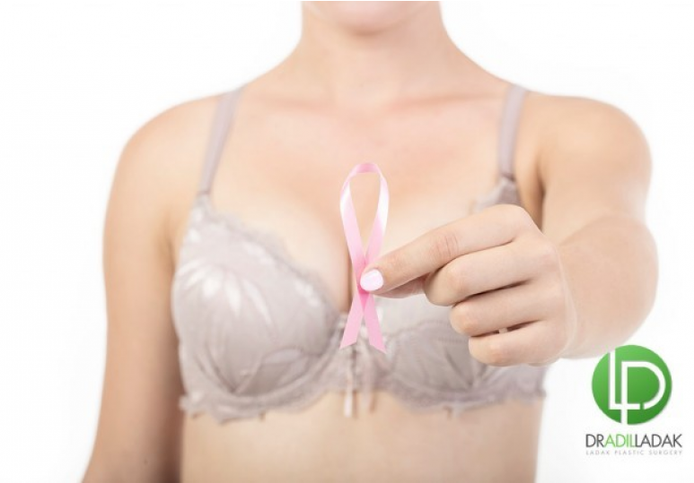 Reconstructing The Breasts After Mastectomy or Lumpectomy