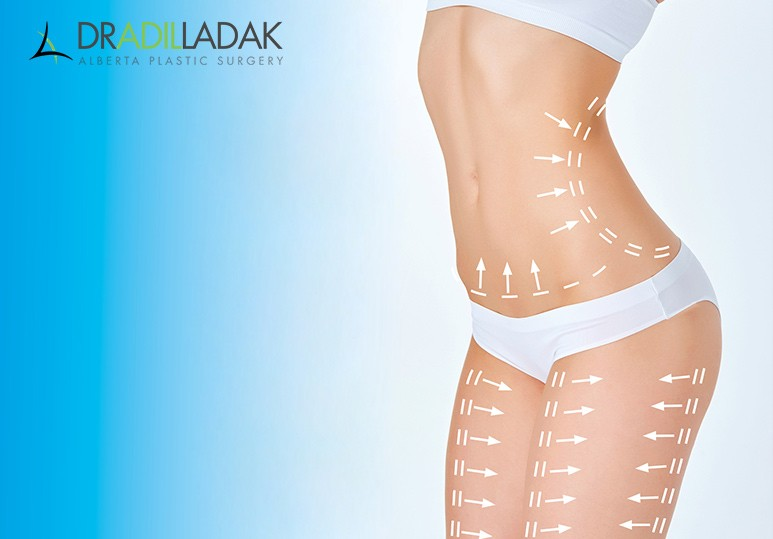 Can Liposuction Get Rid of Back Rolls?