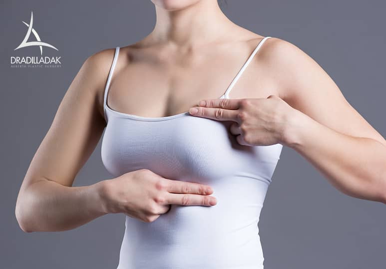 Alberta Plastic - Mantaining Breast Lift Augmentation