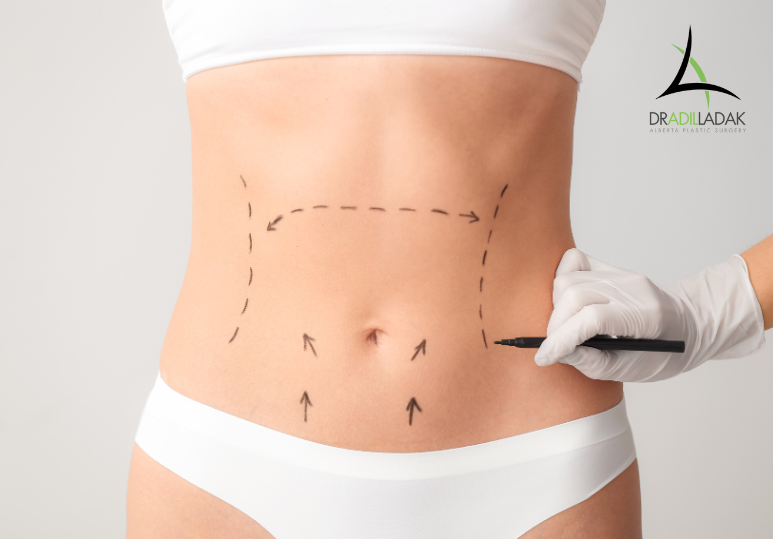 Why Fall and Winter Are Ideal for Plastic Surgery | Alberta Plastic Surgery
