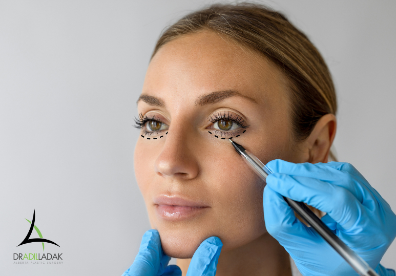 Is Eyelid Surgery in Edmonton Just Cosmetic? Here’s What It Really Treats 