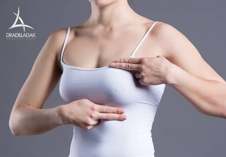 Choosing Bras After Breast Surgery Alberta Plastic Surgery, Edmonton