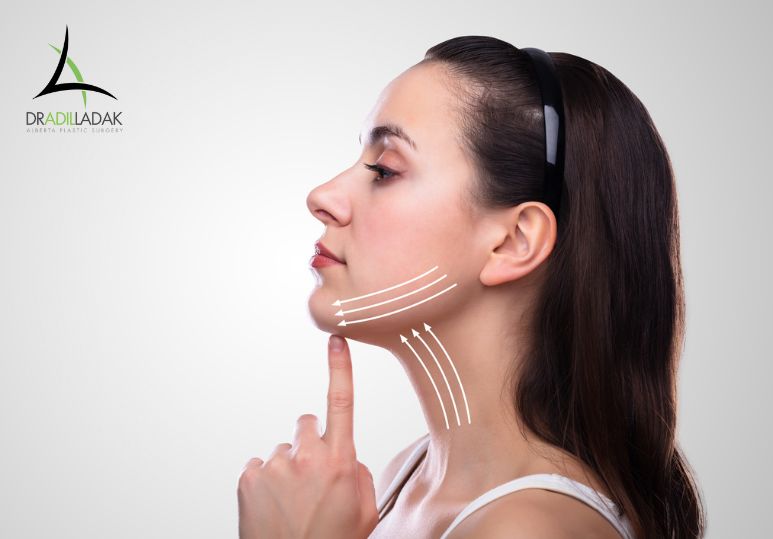 The Ultimate Guide to Necklift Surgery: What You Need to Know