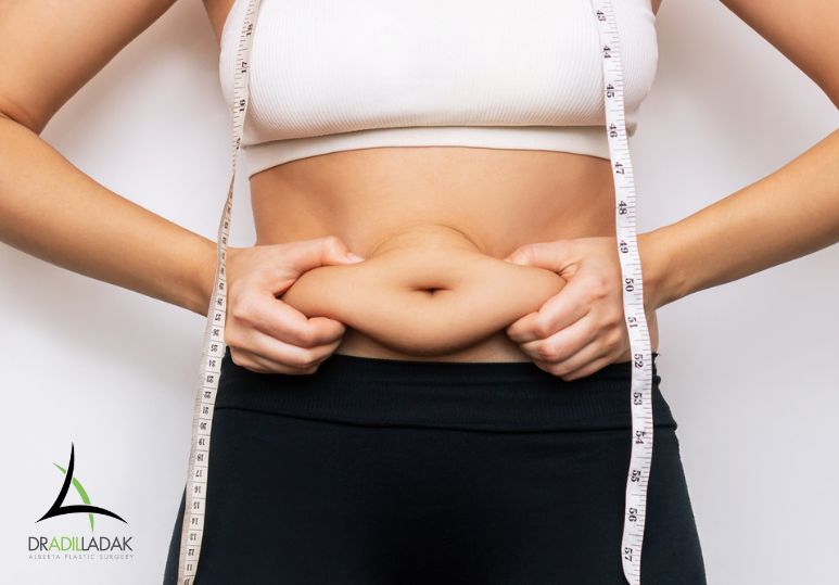 Understanding the Risks and Rewards of Liposuction