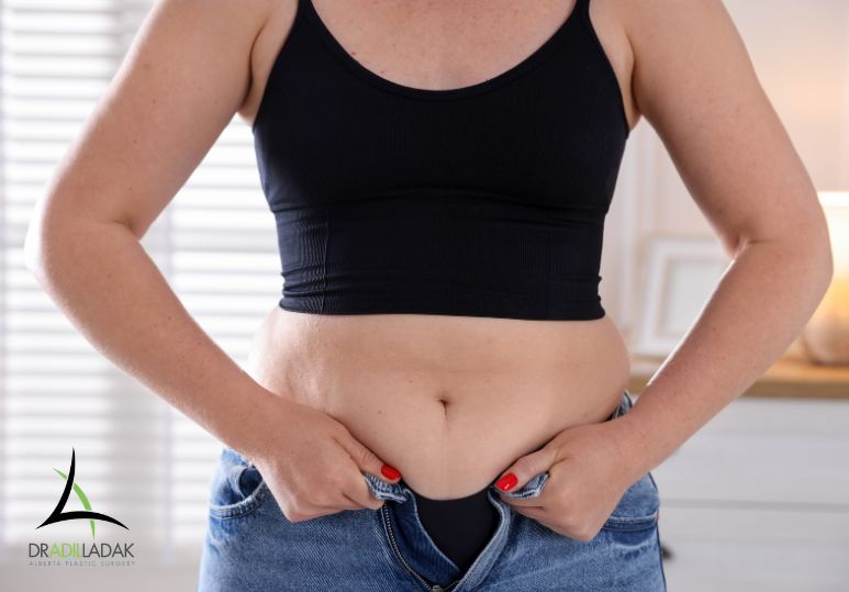 Risks, Safety, and Complications of Liposuction – Liposuction Edmonton